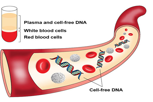 what is cfDNA.jpg